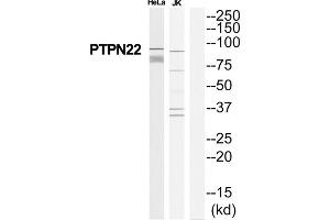 Western Blotting (WB) image for anti-Tyrosine-Protein Phosphatase Non-Receptor Type 22 (PTPN22) (Internal Region) antibody (ABIN1852320) (PTPN22 抗体  (Internal Region))