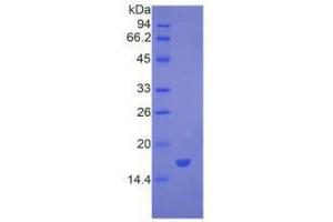 Image no. 1 for Bone Morphogenetic Protein 7 (BMP7) (AA 292-430) (Active) protein (His tag) (ABIN6239791) (BMP7 Protein (AA 292-430) (His tag))