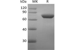 Western Blotting (WB) image for CD209 (CD209) protein (Fc Tag) (ABIN7319880) (DC-SIGN/CD209 Protein (Fc Tag))