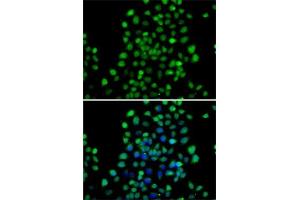 Immunofluorescence analysis of A-549 cells using NTMT1 antibody (ABIN6133076, ABIN6144899, ABIN6144900 and ABIN6222903). (METTL11A 抗体  (AA 1-223))