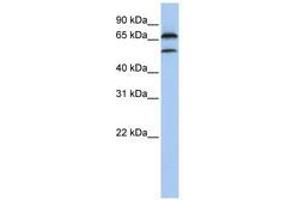 Image no. 1 for anti-F-Box Protein 7 (FBXO7) (C-Term) antibody (ABIN6740800) (FBXO7 抗体  (C-Term))