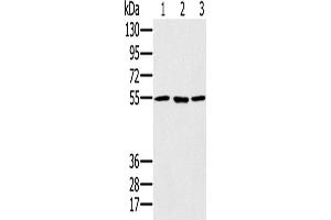 Western Blotting (WB) image for anti-Proteasome (Prosome, Macropain) 26S Subunit, ATPase, 1 (PSMC1) antibody (ABIN2424000) (PSMC1 抗体)