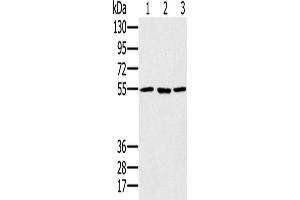 Western Blotting (WB) image for anti-Proteasome (Prosome, Macropain) 26S Subunit, ATPase, 1 (PSMC1) antibody (ABIN2424001) (PSMC1 抗体)