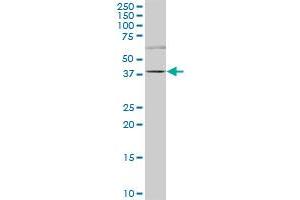 TRIM6-TRIM34 polyclonal antibody (A01), Lot # 060728QCS1. (TRIM6-TRIM34 抗体  (AA 641-740))