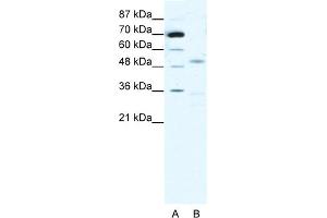 WB Suggested Anti-CHRNG Antibody Titration:  1. (CHRNA3 抗体  (N-Term))