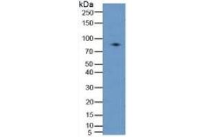 WB of Protein Standard: different control antibodies  against Highly purified E. (PLAA ELISA 试剂盒)