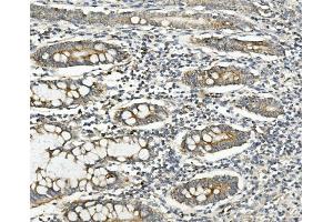 IHC analysis of Methylmalonyl Coenzyme A using anti-Methylmalonyl Coenzyme A antibody (ABIN7603112). (MUT 抗体  (N-Term))