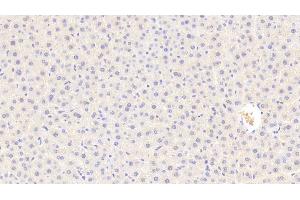 Detection of C5a in Rat Liver Tissue using Polyclonal Antibody to Complement Component 5a (C5a) (C5A 抗体  (AA 12-64))