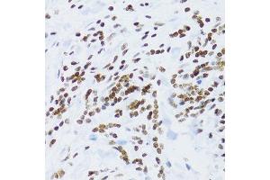Immunohistochemistry (Paraffin-embedded Sections) (IHC (p)) image for anti-Nuclear Factor of kappa Light Polypeptide Gene Enhancer in B-Cells 2 (NFKB2) (AA 690-899) antibody (ABIN3017388)