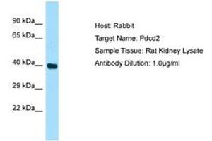 Image no. 1 for anti-Programmed Cell Death 2 (PDCD2) (AA 91-140) antibody (ABIN6749809) (PDCD2 抗体  (AA 91-140))