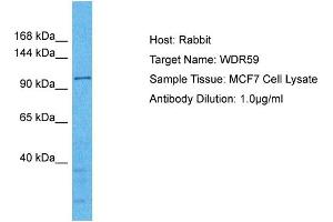 Host: Rabbit Target Name: WDR59 Sample Type: MCF7 Whole Cell lysates Antibody Dilution: 1. (WDR59 抗体  (C-Term))