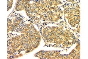 IHC analysis of GM130 using anti-GM130 antibody (ABIN6719432). (Golgin A2 (GOLGA2) (AA 796-913) 抗体)