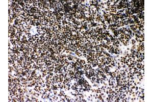 Anti- SIRT7 Picoband antibody, IHC(P) IHC(P): Mouse Spleen Tissue (SIRT7 抗体  (AA 8-350))
