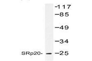 Image no. 1 for anti-serine/arginine-Rich Splicing Factor 3 (SRSF3) antibody (ABIN317610) (SRSF3 抗体)