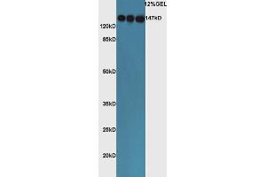 Lane 1: mouse lung lysates Lane 2: mouse liver lysates, Lane 3: mouse adrenal lysates probed with Rabbit Rabbit Anti-ACE Polyclonal Antibody, Unconjugated  at 1:5000 for 90 min at 37˚C. (Angiotensin I Converting Enzyme 1 抗体  (AA 801-900))