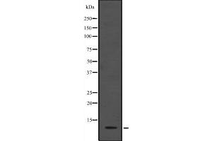 Western blot analysis of ANAPC13 expression in HEK293 cells ,The lane on the left is treated with the antigen-specific peptide.