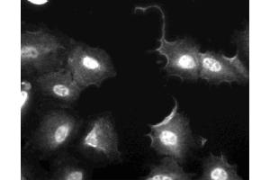 Immunofluorescent staining of U2OS (ATCC HTB-96) cells. (FAK 抗体  (AA 354-533))
