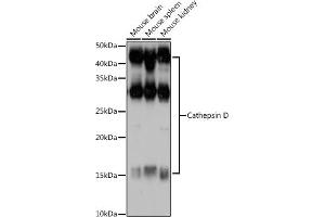 Western blot analysis of extracts of various cell lines, using Cathepsin D antibody (ABIN6127553, ABIN6139223, ABIN6139224 and ABIN6217233) at 1:1000 dilution. (Cathepsin D 抗体  (AA 65-412))