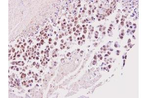 IHC-P Image Immunohistochemical analysis of paraffin-embedded SNU16 xenograft, using TIMELESS, antibody at 1:100 dilution. (TIMELESS 抗体  (N-Term))