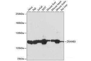 Western blot analysis of extracts of various cell lines using ZRANB3 Polyclonal Antibody at dilution of 1:3000. (ZRANB3 抗体)