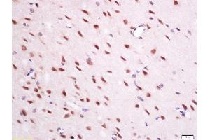 paraformaldehyde-fixed, paraffin embedded mouse brain tissue; Antigen retrieval by boiling in sodium citrate buffer(pH6) for 15min; Block endogenous peroxidase by 3% hydrogen peroxide for 30 minutes; Blocking buffer (normal goat serum) at 37°C for 20min; Antibody incubation with Rabbit Anti-QRFP Polyclonal Antibody, Unconjugated  at 1:200 overnight at 4°C, followed by a conjugated secondary and DAB staining (Neuropeptide 抗体  (AA 91-133))