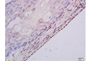 Formalin-fixed and paraffin embedded rat ovary labeled with Anti MSH3 Polyclonal Antibody, Unconjugated (ABIN1387851) at 1:200 followed by conjugation to the secondary antibody and DAB staining (MSH3 抗体  (AA 521-620))