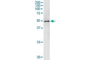 Immunoprecipitation of WAPAL transfected lysate using anti-WAPAL monoclonal antibody and Protein A Magnetic Bead , and immunoblotted with WAPAL monoclonal antibody. (WAPAL 抗体  (AA 1-402))
