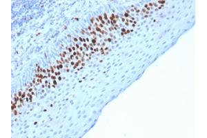 Formalin-fixed, paraffin-embedded human Skin stained with Ki67 Mouse Monoclonal Antibody (MKI67/2463). (Ki-67 抗体  (AA 2293-2478))