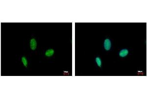 ICC/IF Image RAD23B antibody detects RAD23B protein at nucleus by immunofluorescent analysis. (RAD23B 抗体  (Center))