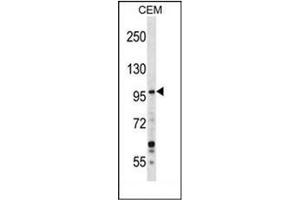 Western Blotting (WB) image for anti-Growth Regulation By Estrogen in Breast Cancer 1 (GREB1) (AA 1416-1446), (Middle Region) antibody (ABIN952627)