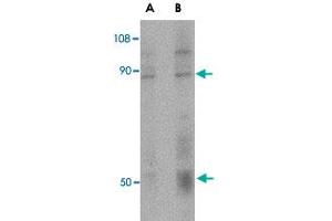 Western blot analysis of CD248 in human colon tissue lysate with CD248 polyclonal antibody  at (A) 0. (CD248 抗体  (C-Term))