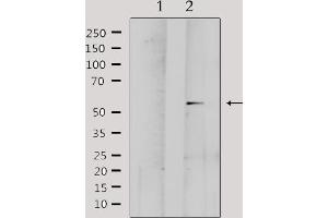 Western blot analysis of extracts from Hela, using MMP1 Antibody. (MMP1 抗体  (C-Term))