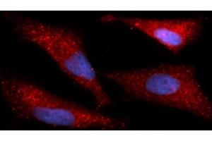 Immunofluorescence (IF) image for anti-Immunoglobulin Binding Protein (BIP) (AA 20-650) antibody (APC) (ABIN5566439) (BIP 抗体  (AA 20-650) (APC))