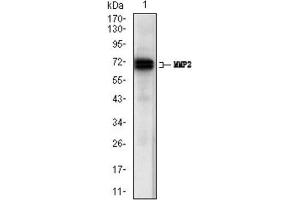 Western Blotting (WB) image for anti-Matrix Metalloproteinase 2 (MMP2) (AA 242-396) antibody (ABIN1844833) (MMP2 抗体  (AA 242-396))