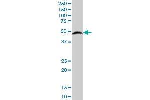 SET7 polyclonal antibody (A01), Lot # 051212JC01 Western Blot analysis of SET7 expression in MCF-7 . (SETD7 抗体  (AA 257-366))