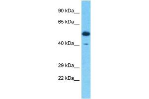 Host:  Rabbit  Target Name:  SERPINB3  Sample Type:  Thymus Tumor lysates  Antibody Dilution:  1. (SERPINB3 抗体  (C-Term))