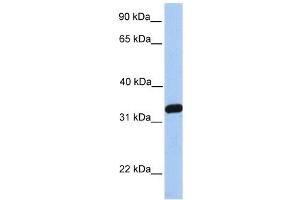 NKIRAS2 antibody used at 1 ug/ml to detect target protein. (NKIRAS2 抗体  (C-Term))