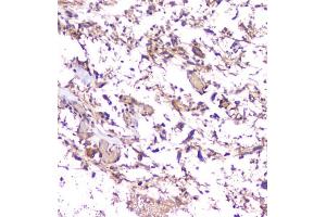 IHC-P: Amyloid beta antibody testing of mouse brain tissue. (APP 抗体  (C-Term))