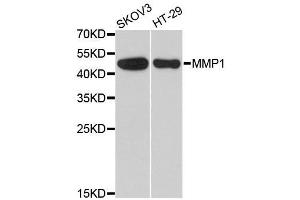 Western blot analysis of extracts of various cell lines, using MMP1 antibody. (MMP1 抗体  (AA 20-280))