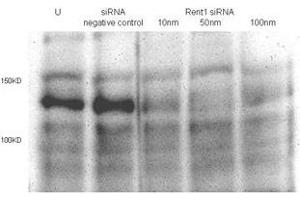 Total lysates (50 μg per lane) from Hela cells untransfected (U) or transfected with negative siRNA control or Rent1 siRNAs of 10nm, 50nm to 100nm. (RENT1/UPF1 抗体  (AA 583-612))
