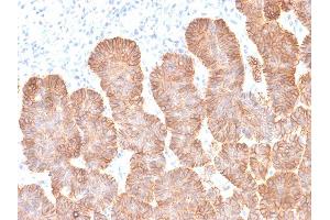 Formalin-fixed, paraffin-embedded human Skin tissue stained with EpCAM Mouse Recombinant Monoclonal Antibody (rEGP40/1372). (Recombinant EpCAM 抗体  (Extracellular Domain))