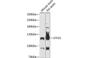 Western blot analysis of extracts of various cell lines, using STK31 antibody (ABIN6132843, ABIN6148608, ABIN6148609 and ABIN6216974) at 1:3000 dilution. (STK31 抗体  (AA 890-1019))