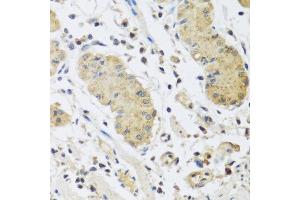 Immunohistochemistry of paraffin-embedded human stomach using IL4 antibody at dilution of 1:100 (40x lens). (IL-4 抗体)