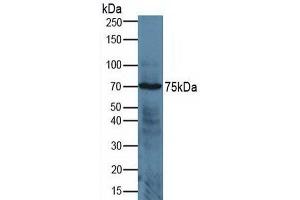 Rabbit Detection antibody from the kit in WB with Positive Control:  Sample Human jurkat cells. (ADAM17 ELISA 试剂盒)