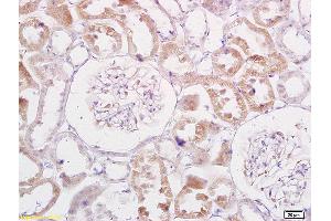 Formalin-fixed and paraffin embedded rat kidney labeled with Anti-TRADD Polyclonal Antibody, Unconjugated (ABIN673314) at 1:200 followed by conjugation to the secondary antibody and DAB staining. (TRADD 抗体  (AA 111-230))