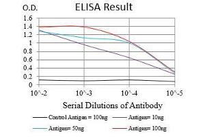 Black line: Control Antigen (100 ng), Purple line: Antigen(10 ng), Blue line: Antigen (50 ng), Red line: Antigen (100 ng), (ZEB1 抗体  (AA 967-1108))