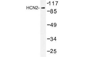 Image no. 1 for anti-Hyperpolarization Activated Cyclic Nucleotide-Gated Potassium Channel 2 (HCN2) antibody (ABIN317931) (HCN2 抗体)