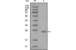 Western blot analysis using AXL mouse mAb against truncated Trx-AXL recombinant protein (1). (AXL 抗体  (AA 466-530))
