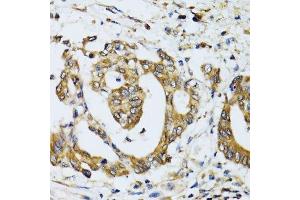 Immunohistochemistry (Paraffin-embedded Sections) (IHC (p)) image for anti-Ribophorin 1 (RPN1) (AA 20-280) antibody (ABIN6147170)