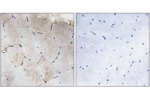 Immunohistochemistry (IHC) image for anti-Collagen, Type XII, alpha 1 (COL12A1) (AA 1481-1530) antibody (ABIN1534353)